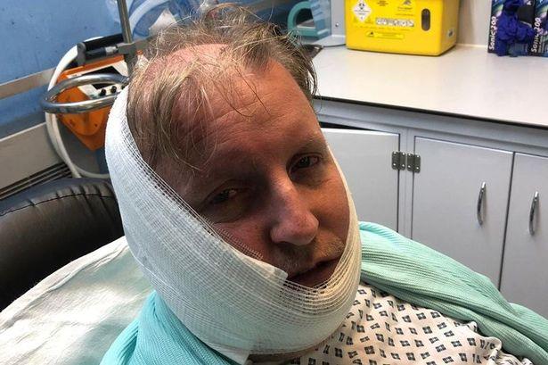 Mężczyzna  oblany żrącą substancją w Walsall