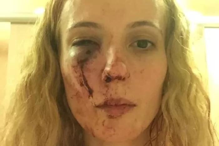 Rasistowski atak na kobietę. Sprawcy myśleli, że jest Polką