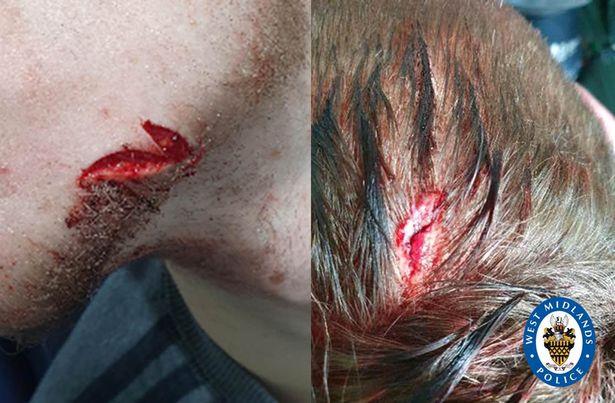 Chłopak i dziewczyna zaatakowani przez grupę nastolatków na przystanku w Birmingham