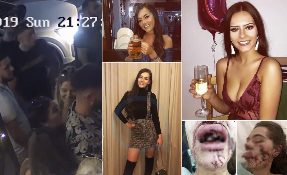 Mężczyzna rzucił butelką wina w przypadkową kobietę. Jej twarz została zmiażdżona