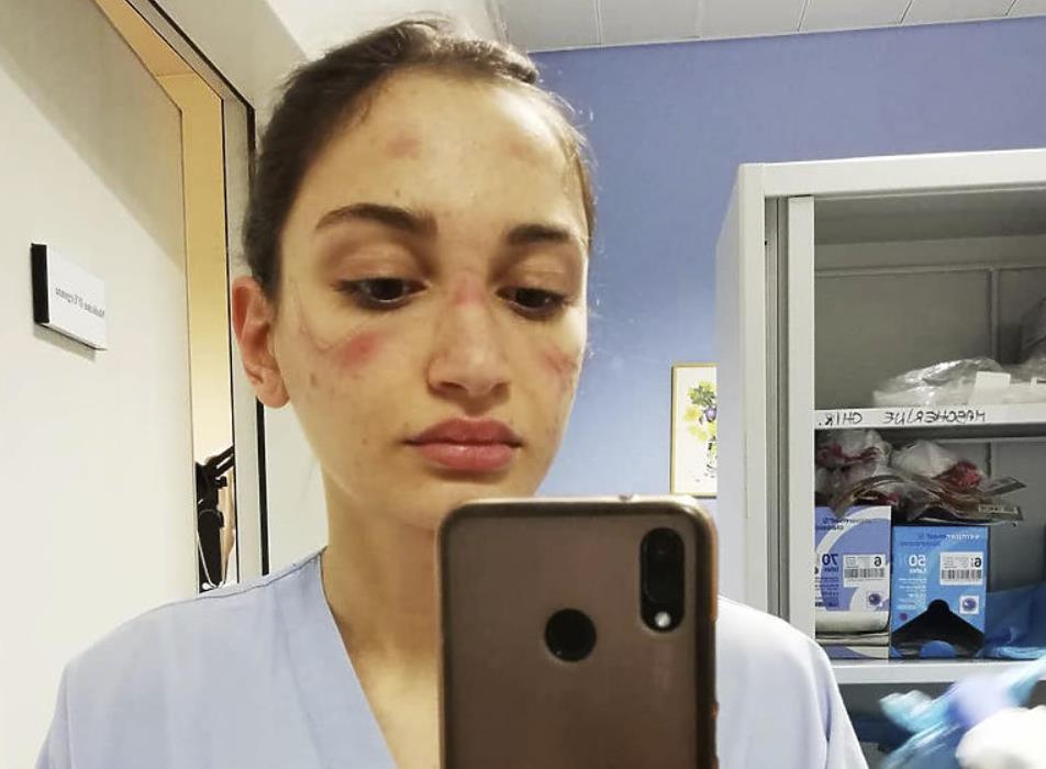 Szokujący apel włoskiej pielęgniarki. Młoda kobieta opowiada jak wygląda nierówna walka z koronawirusem