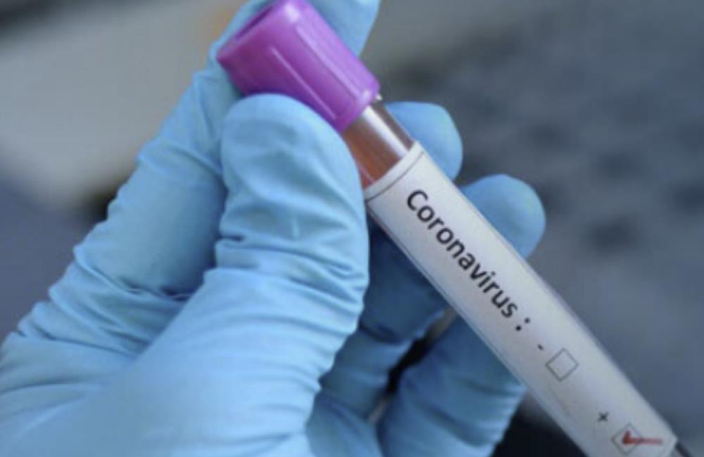 Koronawirus „zabije 250 000 ludzi w UK, jeśli kraj nie wprowadzi stanu wyjątkowego”