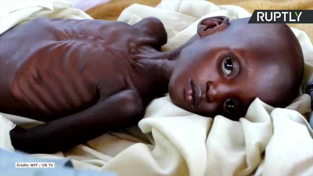 Pandemia koronawirusa może podwoić liczbę osób cierpiących z powodu głodu na świecie