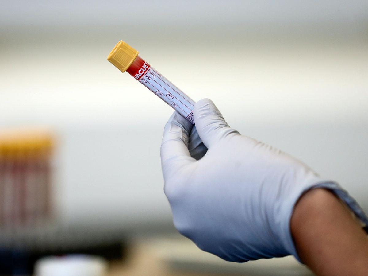 Koronawirus z RPA w Wielkiej Brytanii. Ruszają masowe testy