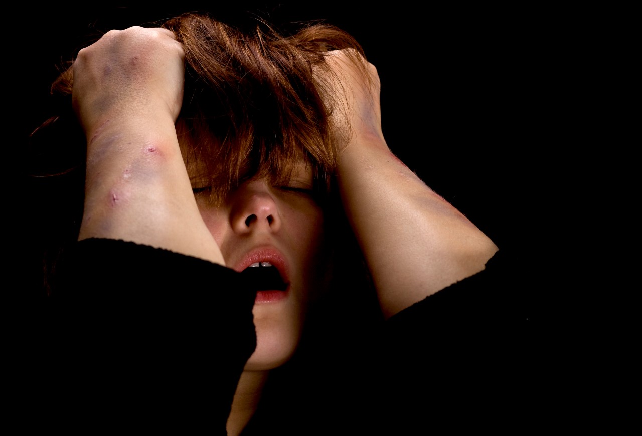 Szokująca liczba napaści przy użyciu kwasów w West Midlands