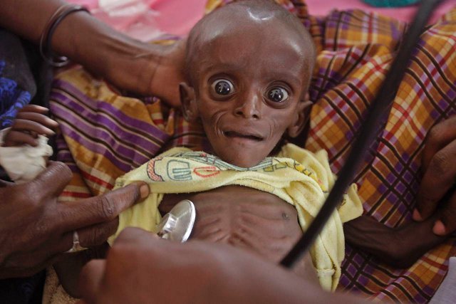 Uratuj głodujące dziecko!