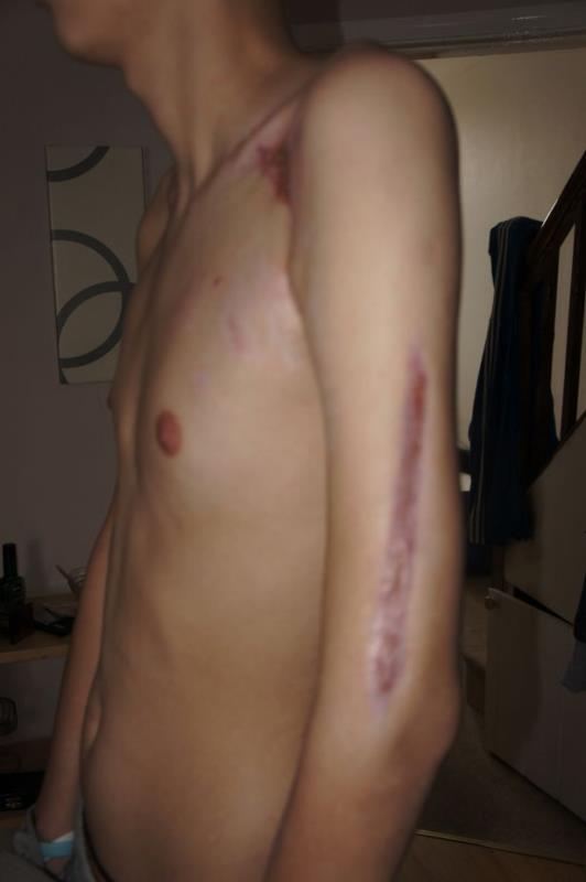 Firma, w której Polak doznał ciężkich obrażeń ciała została ukarana