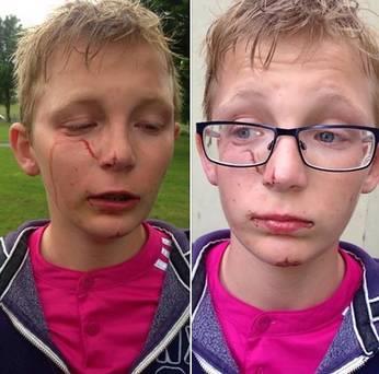 11-letni Polak z Irlandii Północnej ofiarą rasistowskiego ataku