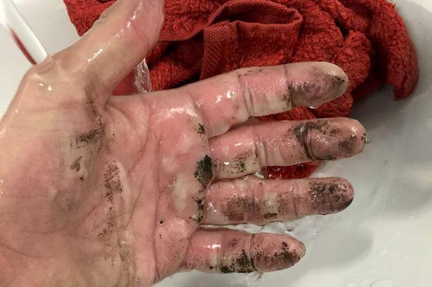 Ładowarka od EE wybuchła pod łóżkiem studentki i spowodowała oparzenia II stopnia