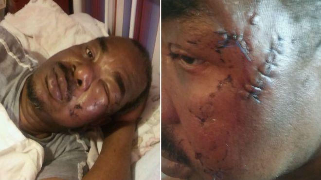 Starszy mężczyzna zaatakowany przez psa – lekarze założyli mu 15 szwów