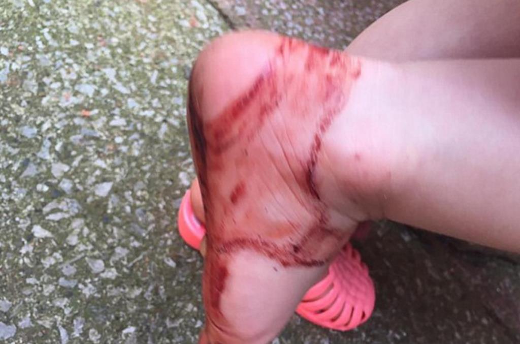 Uwaga na gumowe sandałki ze sklepu Next