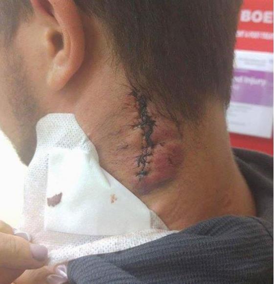 Polak ugodzony rozbitą butelką w szyję opisuje brutalną napaść w Telford