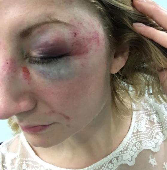 Brutalna kradzież samochodu w Jewellery Quarter