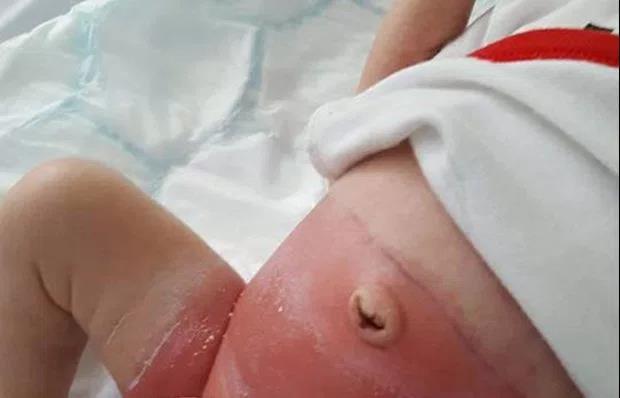 Pieluchy z Asdy wywołały u niemowlaka wysypkę - sieć wycofuje je ze sklepów