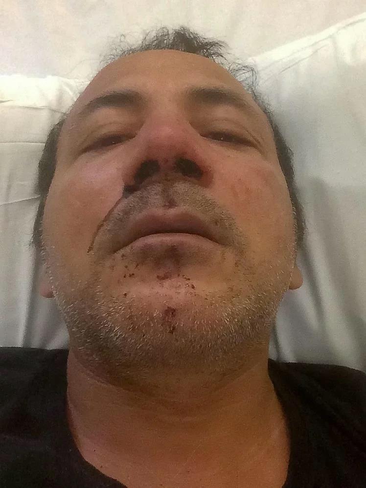 Pakistański chrześcijanin zaatakowany przez muzułmanów za to, że ozdobił samochód makami