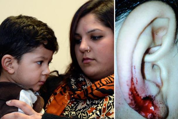 Dziecko straciło ucho w przedszkolu